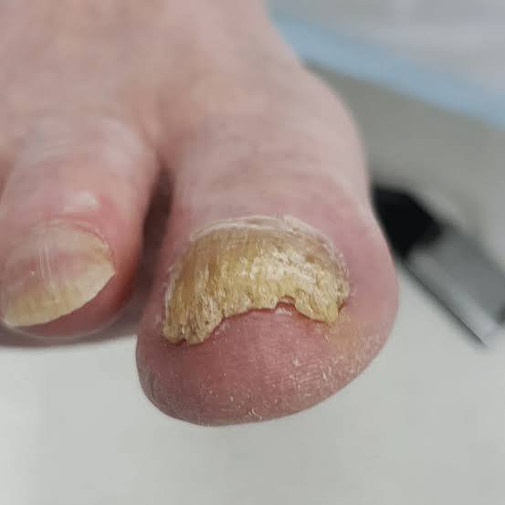 Age And Nails A Beginner S Guide