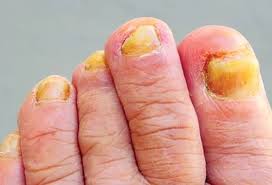 Age And Nails Common Questions Answered