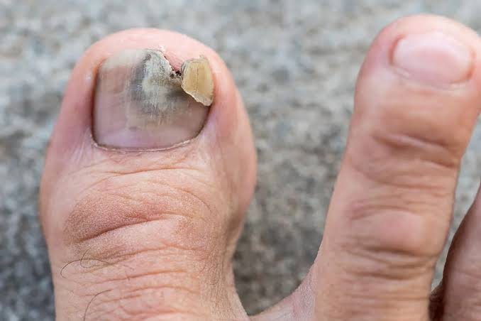 Age And Nails Everyday Checklist