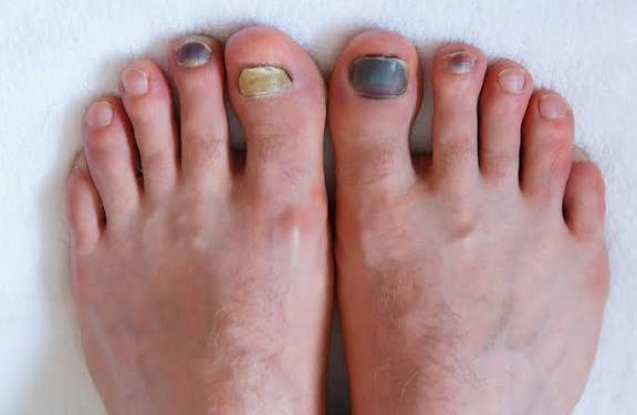 Age And Nails Practical Tips