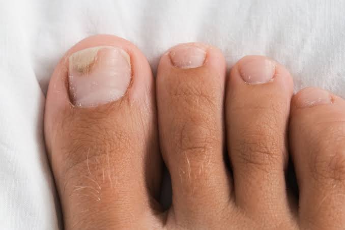Age And Nails Safety Tips