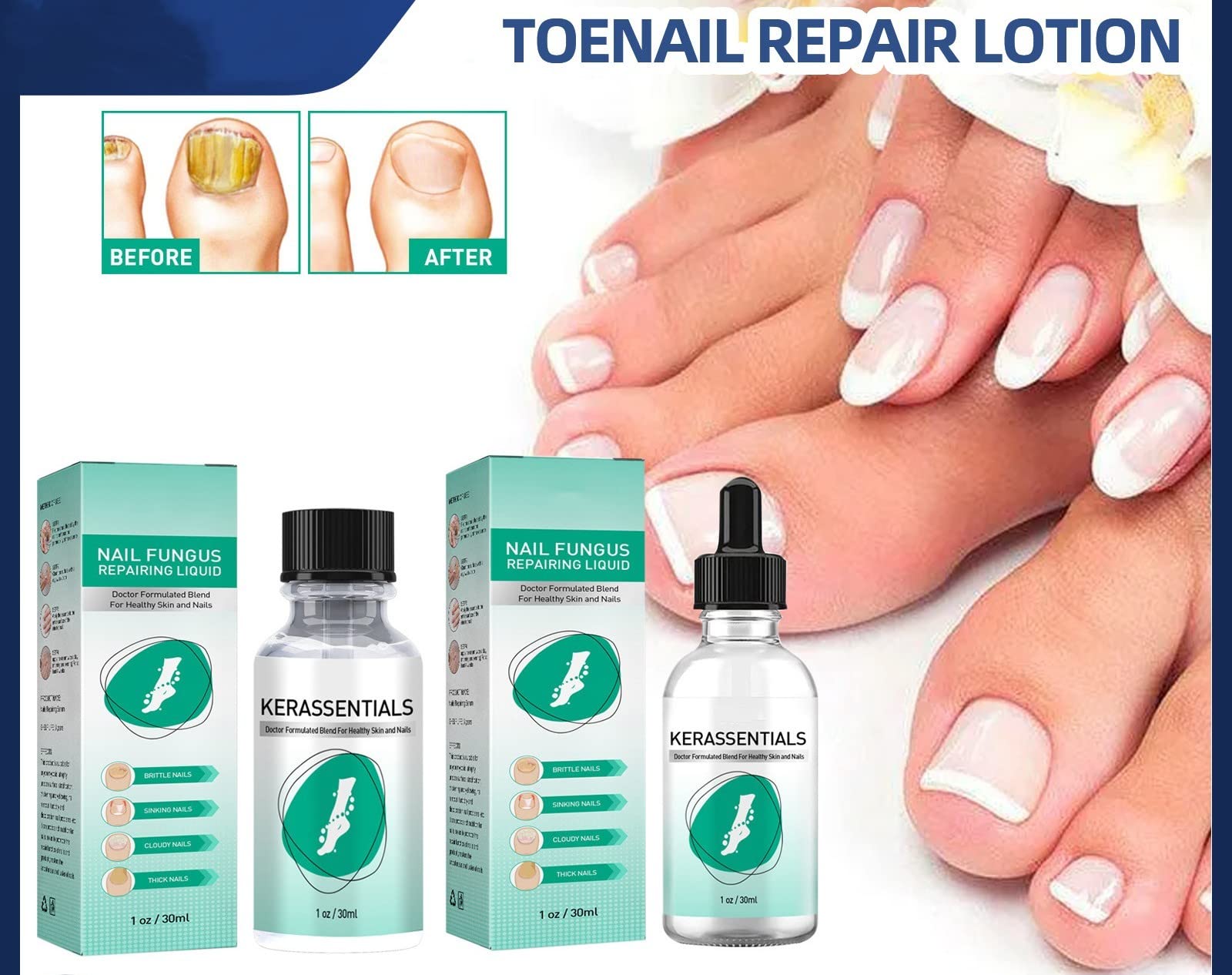 Age And Nails Signs And Causes